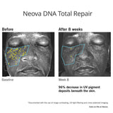 Neova DNA Total Repair results