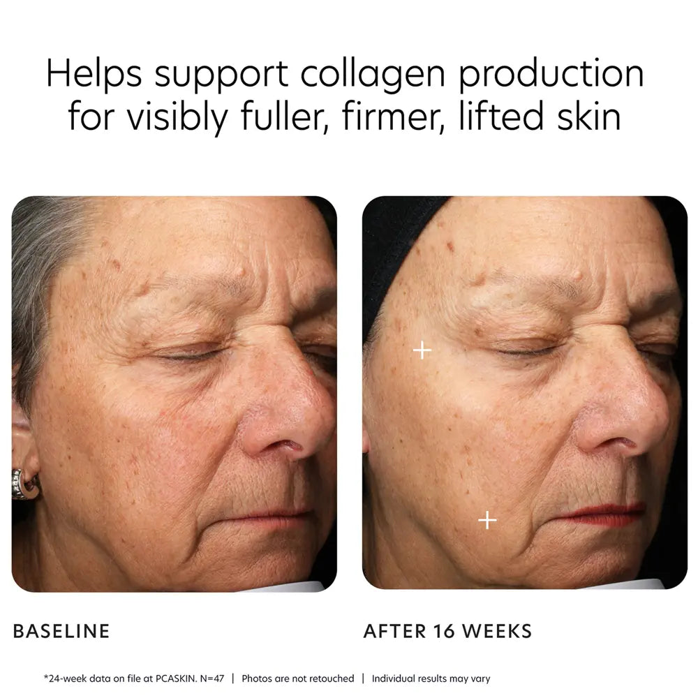 PCA Skin MGF Age Renewal Moisturizer Cream