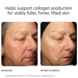 PCA Skin MGF Age Renewal Moisturizer Cream