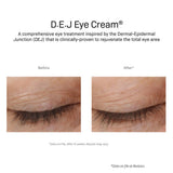 DEj Eye Cream Results after 12 weeks