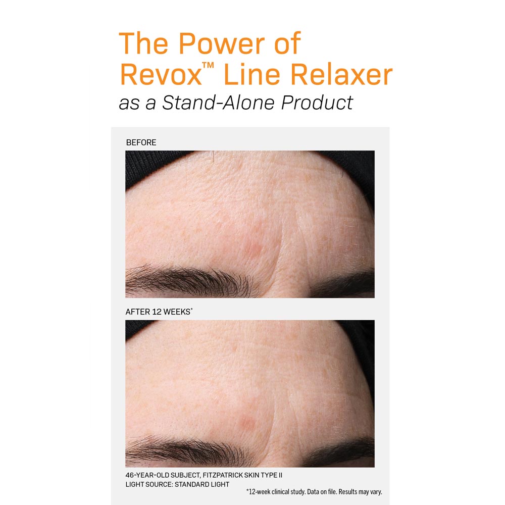 Revox Line Relaxer before and after forehead wrinkles