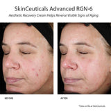 SkinCeuticals Advanced RGN-6
