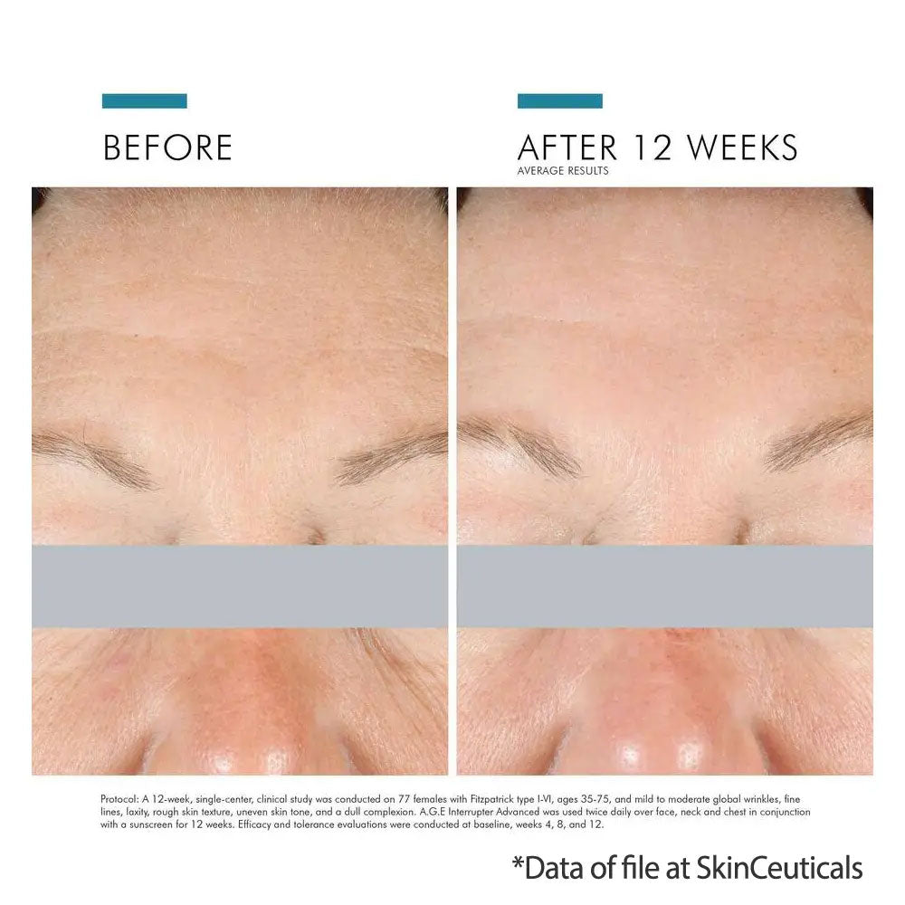SkinCeuticals A.G.E. Interrupter Advanced Anti-Aging Cream