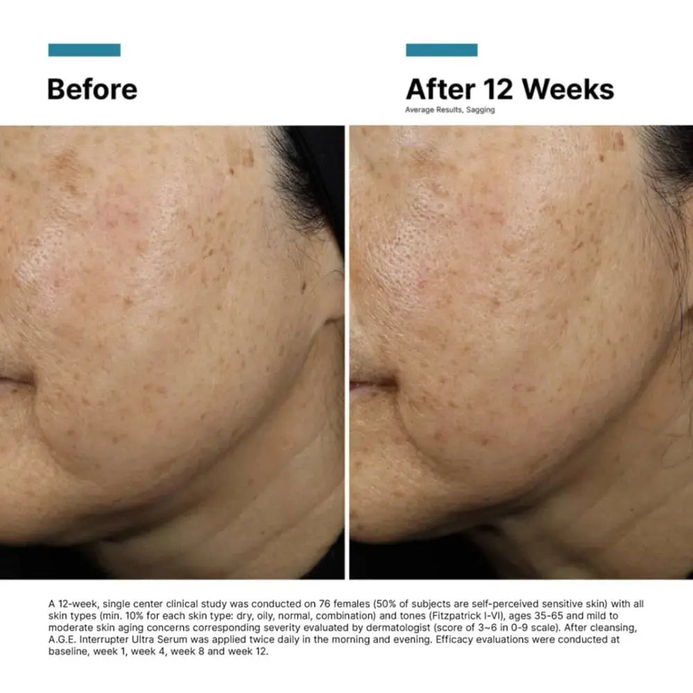 SkinCeuticals A.G.E. Interrupter Ultra Serum