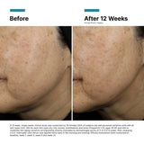 SkinCeuticals A.G.E. Interrupter Ultra Serum