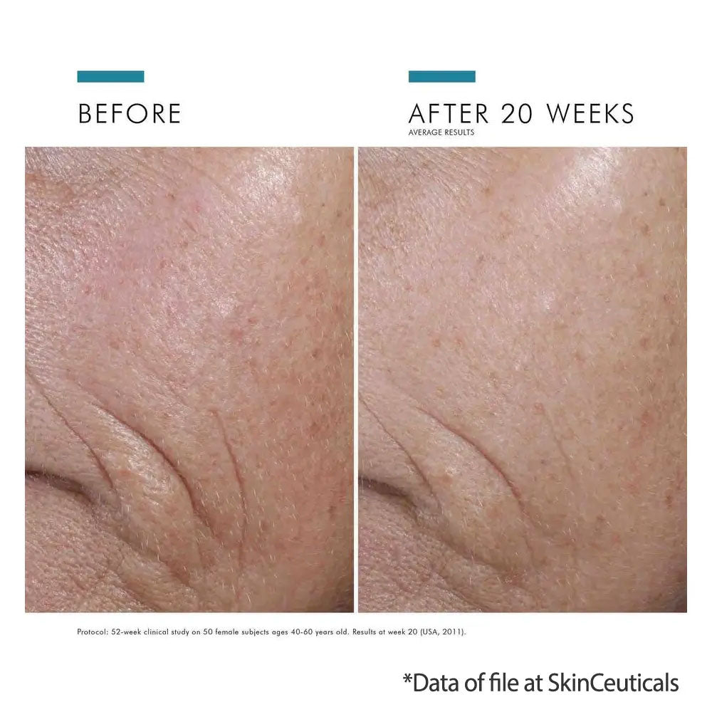 SkinCeuticals C E Ferulic results