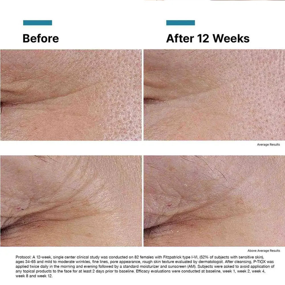 Model is applying a drop of SkinCeuticals P-TIOX Anti-wrinkle serum before and after results show less wrinkles