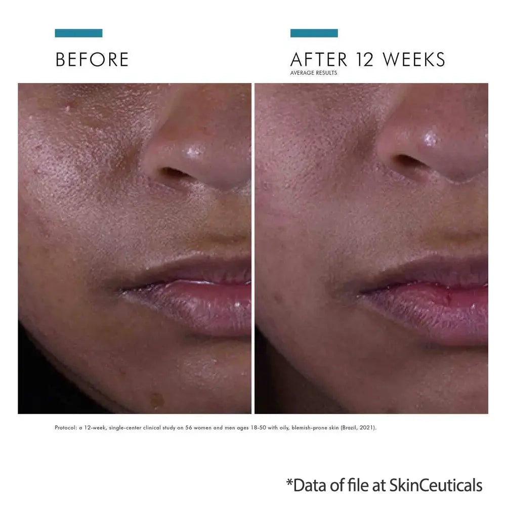 SkinCeuticals Silymarin CF ingredients results on oily skin