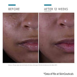 SkinCeuticals Silymarin CF ingredients results on oily skin