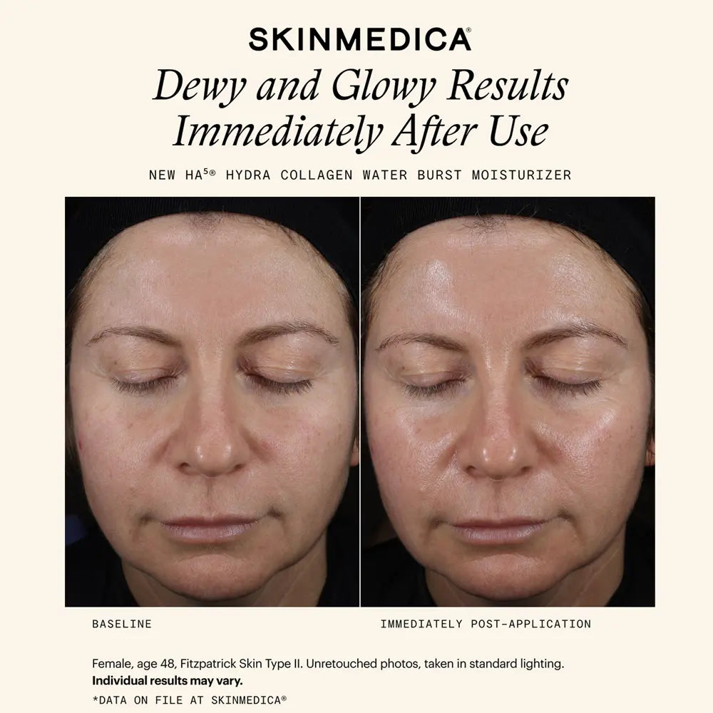 SkinMedica HA5 Hydra Collagen Water Burst Moisturizer