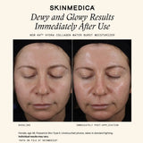 SkinMedica HA5 Hydra Collagen Water Burst Moisturizer