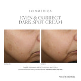 SkinMedica Even and Correct Advanced Brightening Serum results