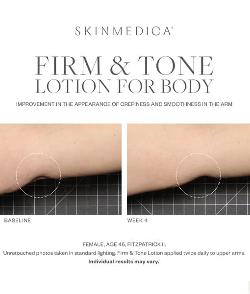 SkinMedica Firm & Tone Body Lotion - Body Firming | Rejuvent Skincare