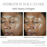 SkinMedica HA5 Hydra Collagen before and after results right after use