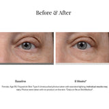 SkinMedica Instant Bright Eye Cream product results 1