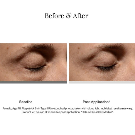 SkinMedica Instant Bright Eye Cream product results 2