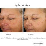 Lumivive day night System from SkinMedica results 1