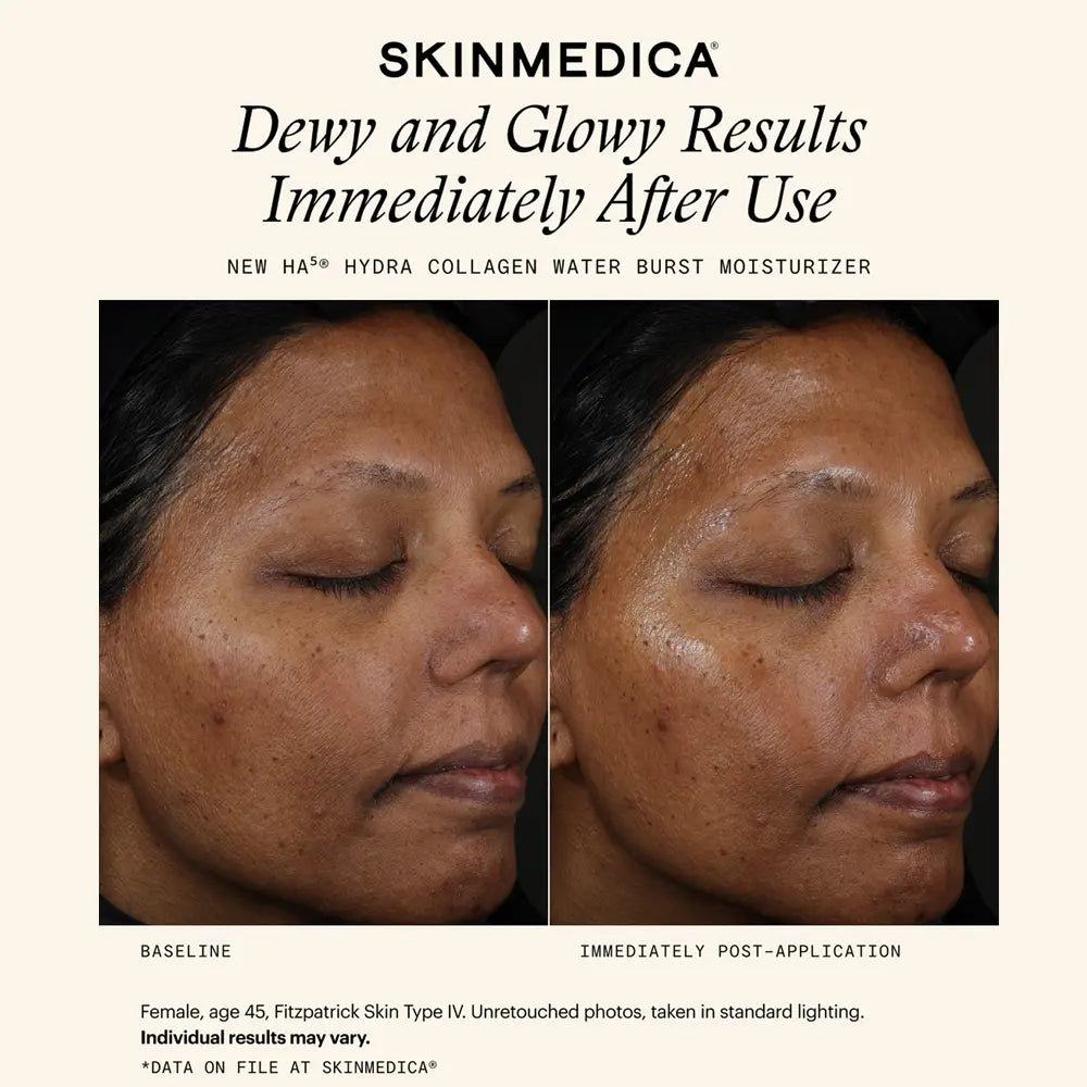 SkinMedica HA5 Hydra Collagen Water Burst Moisturizer