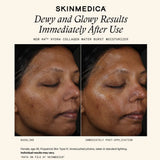 SkinMedica HA5 Hydra Collagen Water Burst Moisturizer