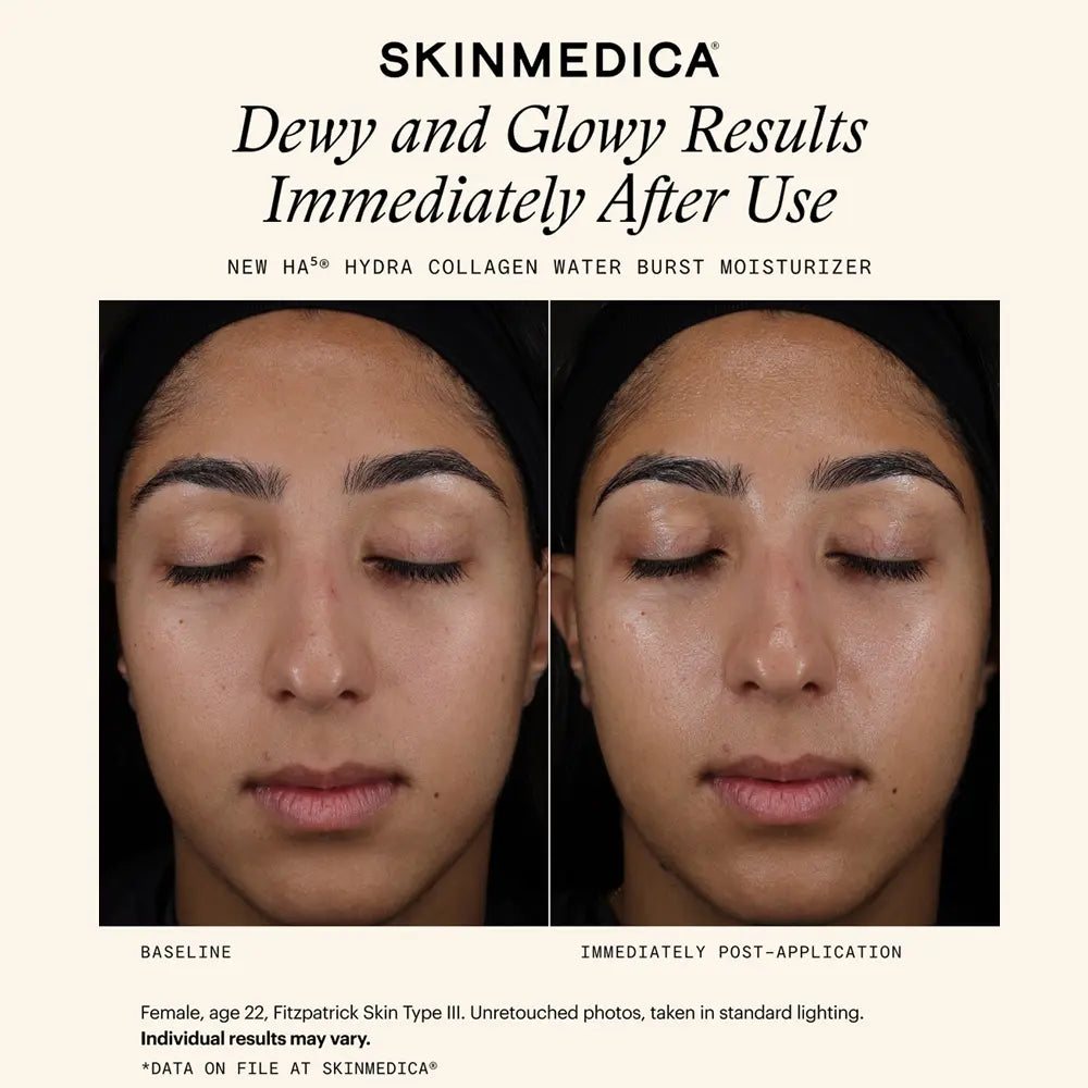 SkinMedica HA5 Hydra Collagen Water Burst Moisturizer