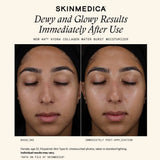 SkinMedica HA5 Hydra Collagen Water Burst Moisturizer