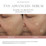 SkinMedica TNS Advanced + results 1