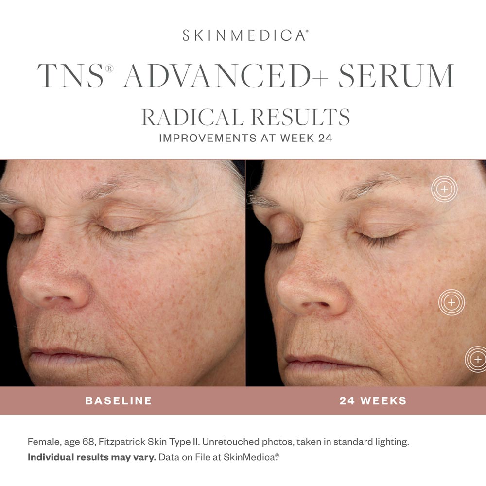 SkinMedica TNS Advanced + results 2
