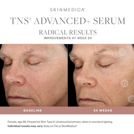 SkinMedica TNS Advanced + results 2