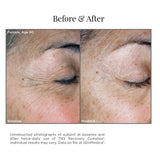 SkinMedica TNS Recovery Complex results