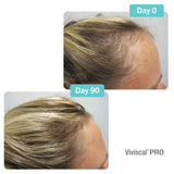 Viviscal Pro Hair Supplements 90 days results