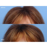 Viviscal Pro Hair Supplements front view results
