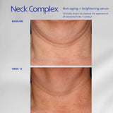 ZO Skin Health Neck Complex Anti-Aging + Brightening Serum