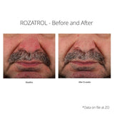 Rozatrol results on male